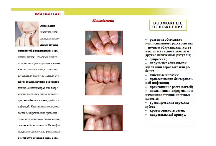 Вред от грызения ногтей